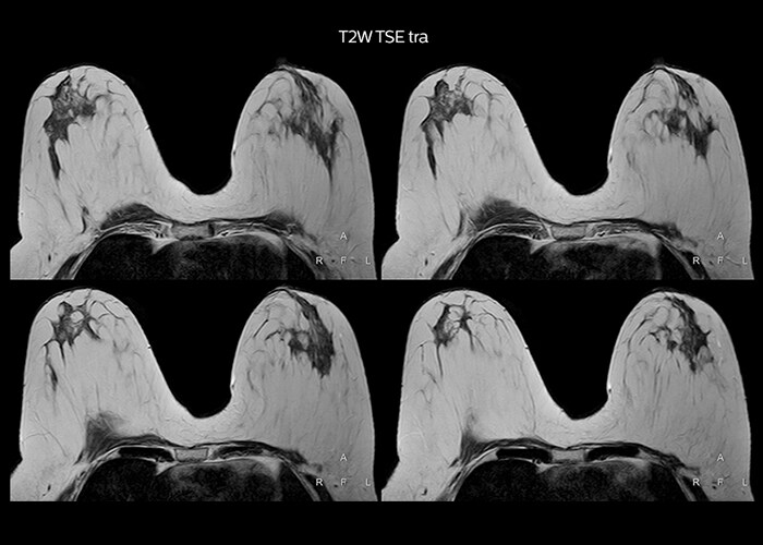 clinical cases tab3 image2