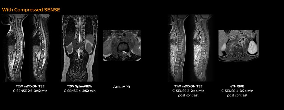 clinical image pediatric spine compressed sense desktop